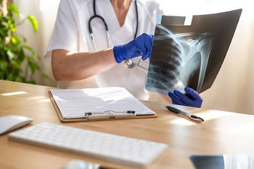 Médico-observando-radiografia-en-una-mesa