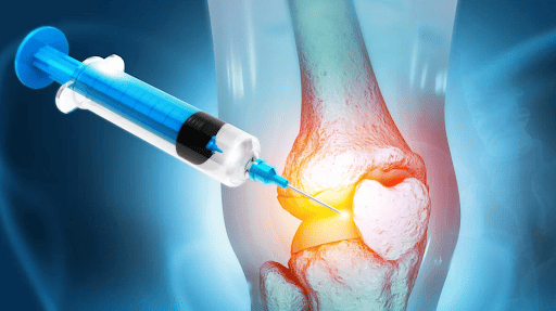 Tratamiento-infiltración-rodilla